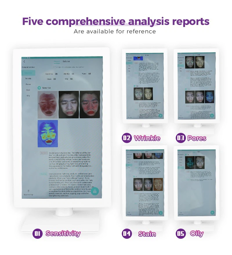 Skin Analyzer for Clinic and Spa Detect Wrinkles Pores and Pigmentation Skin Analyzer for Clinic and Spa Detect Wrinkles Pores and Pigmentation